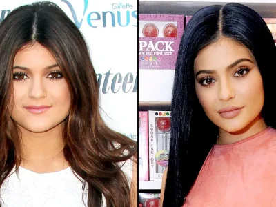 transformasi Kylie Jenner