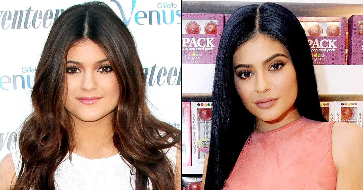 Aneka Rupa Kylie Jenner dari Kecil hingga Kini, Beda Banget!