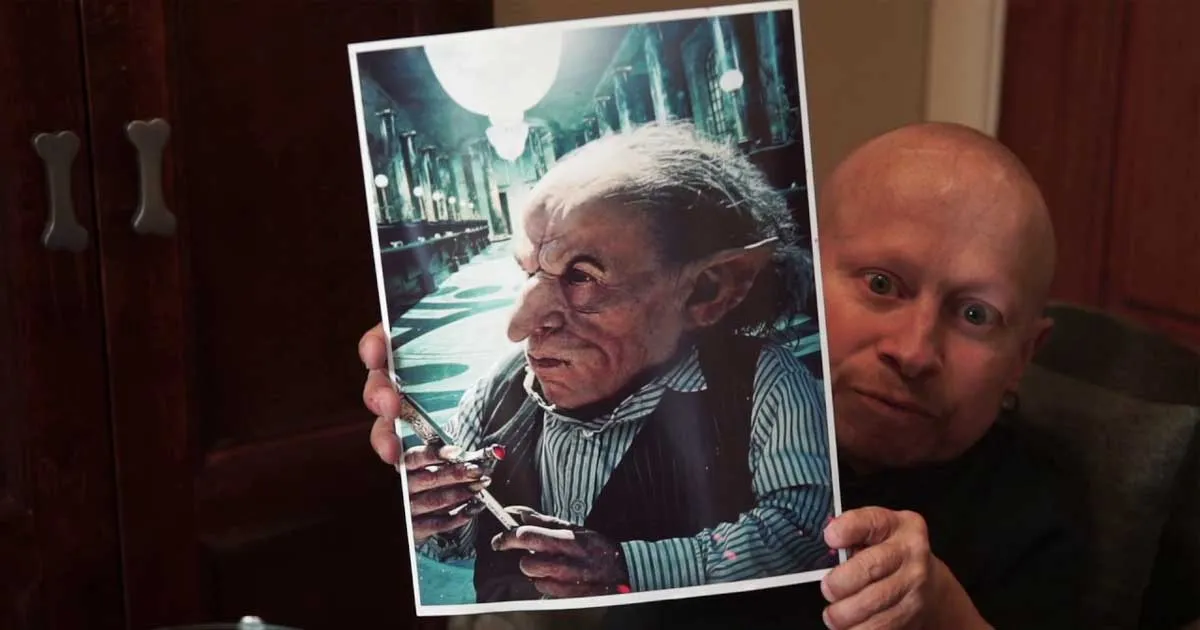 Susul Prof. Snape, Verne ‘Griphook’ Troyer Meninggal di Usia 49 Tahun