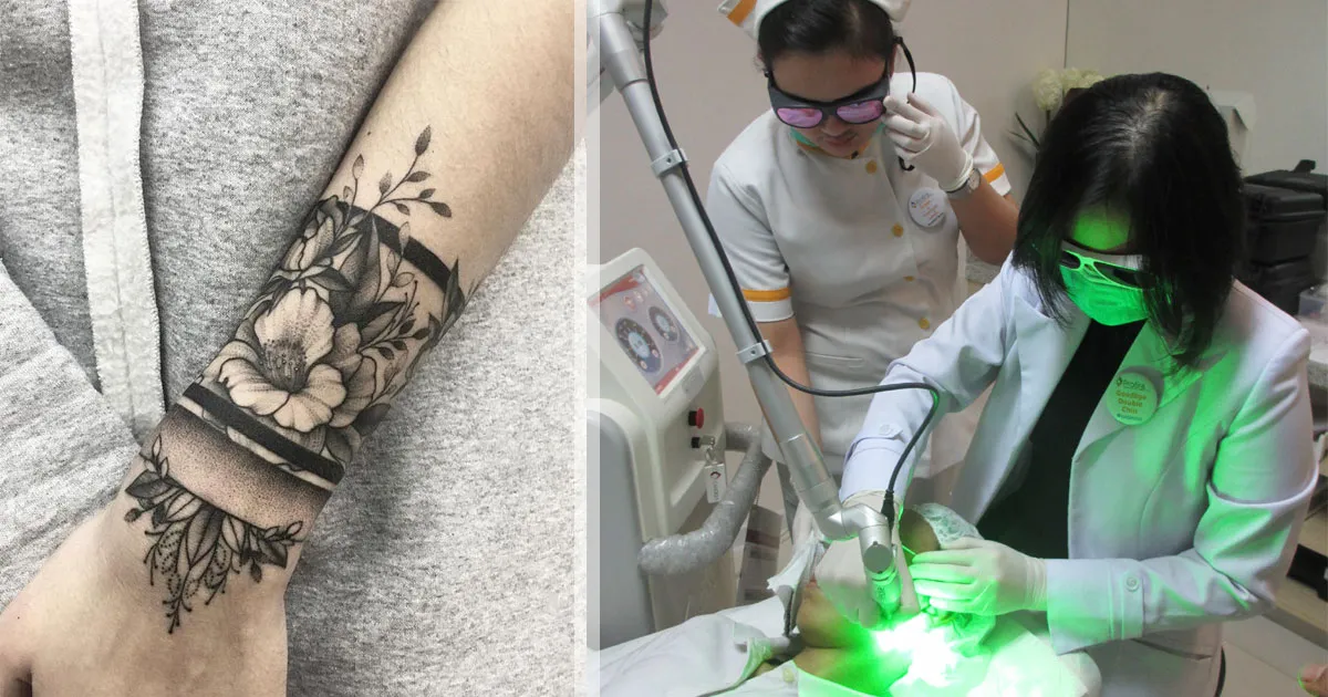 Tak Hanya Hilangkan Tato, Pico Smart Laser Berguna untuk Anti Aging