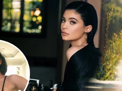 kylie-jenner tanpa lip filler