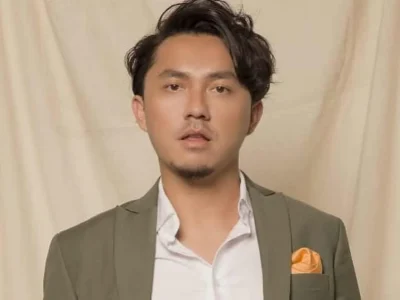 Omesh sakit fobia artis aneh unik