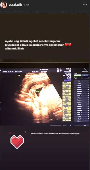 jenis-kelamin-bayi-aura-kasih