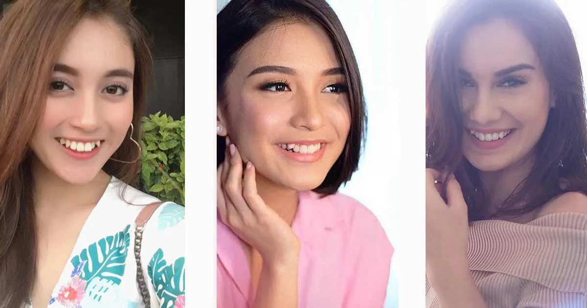Adu Senyum 8 Artis Bergigi Gingsul, Siapa yang Paling Manis?