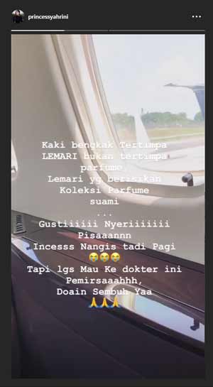 syahrini-kaki-kecelakaan