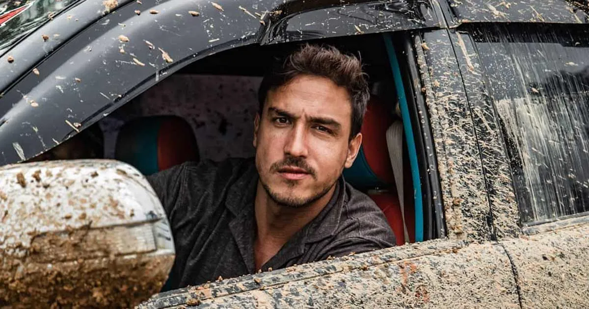 Pamer X-Ray Wajah Penuh Baut, Hamish Daud Sukses Curi Perhatian