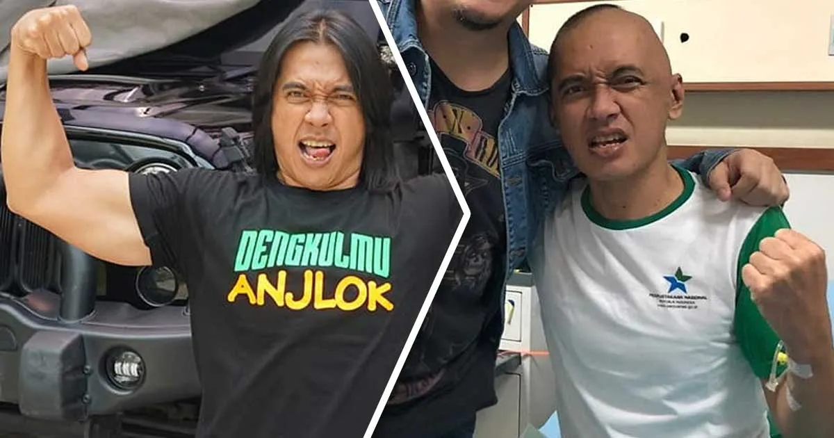 Istri Ungkap Penyakit Agung Hercules yang Sudah Stadium 4