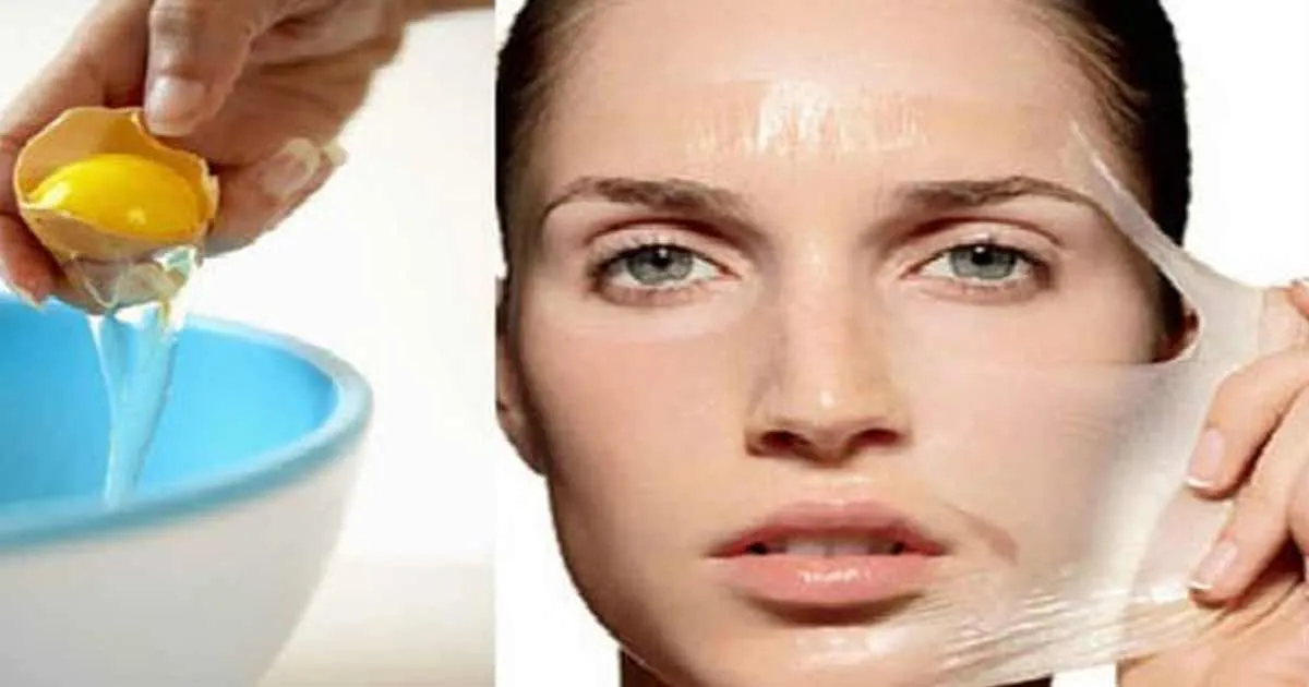 Yuk Buat Sendiri Masker Putih Telur Untuk Atasi Jerawat dan Pori-pori!