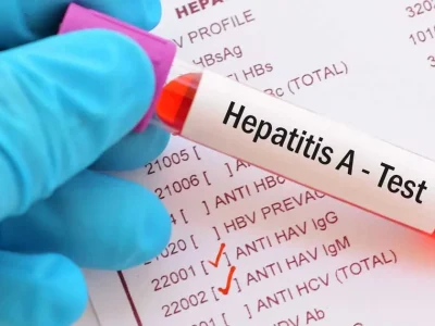 Cegah Hepatitis A