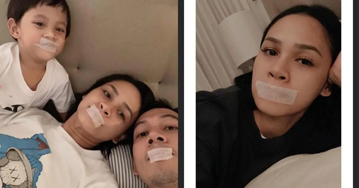 Mengintip Gaya Tidur Andien Aisyah Dengan Mulut Diplester