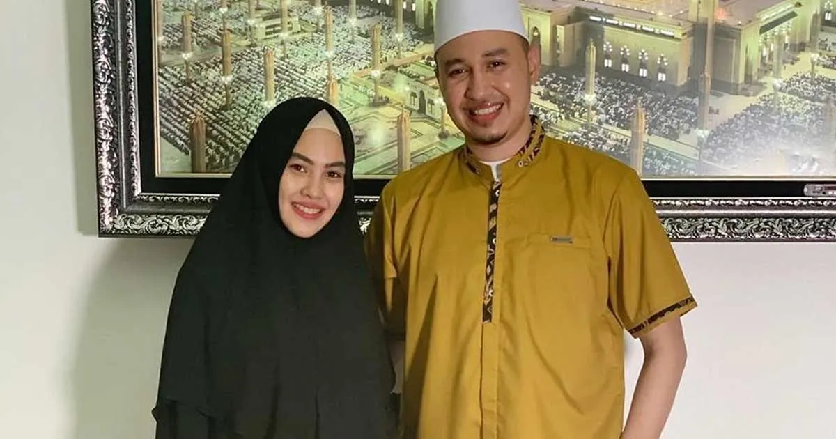 Kartika Putri Dibuat Heboh dengan Bentuk Bibir Calon Bayinya