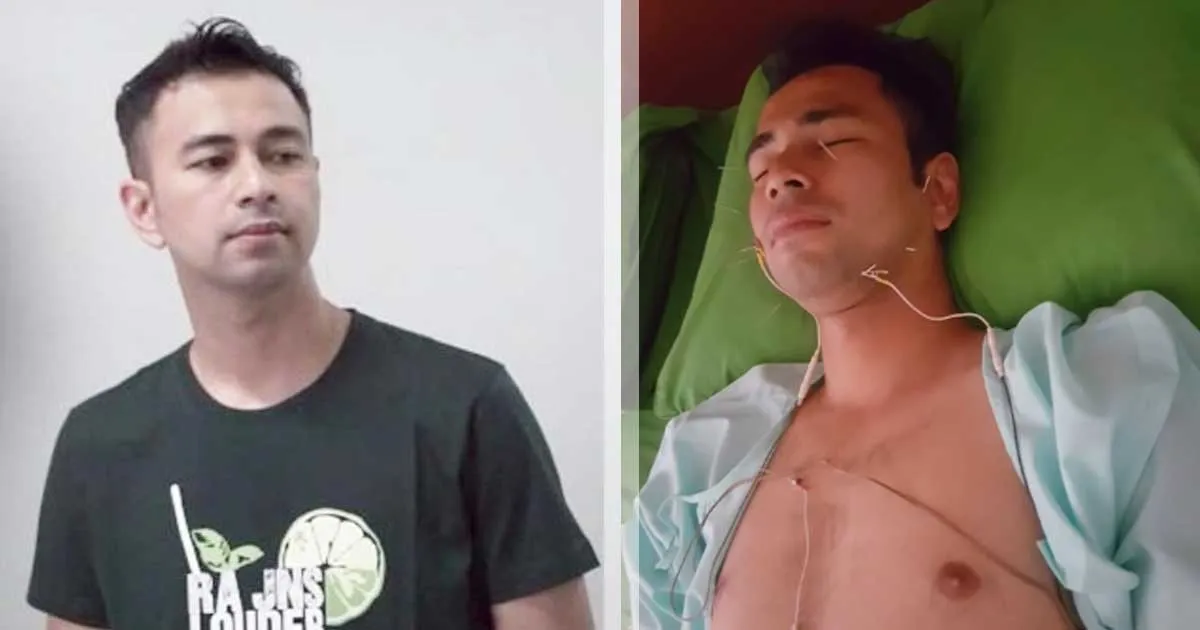Raffi Ahmad Jalani Pengobatan untuk Hipertiroid Level 3