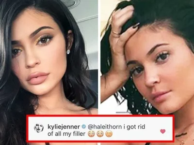 kylie-jenner-tren-perawatan-kecantikan
