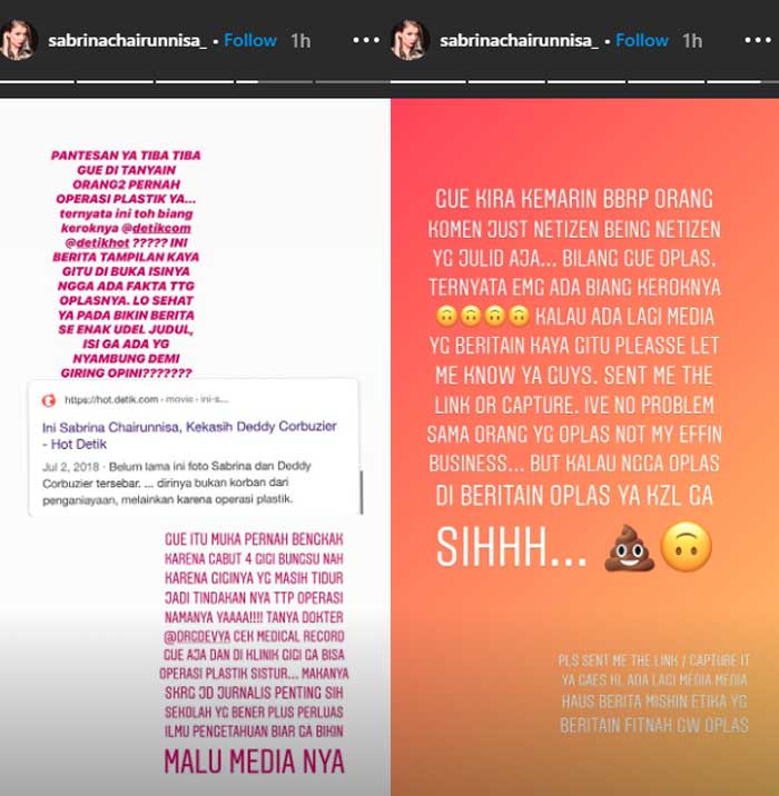 Sabrina Chairunnisa operasi plastik