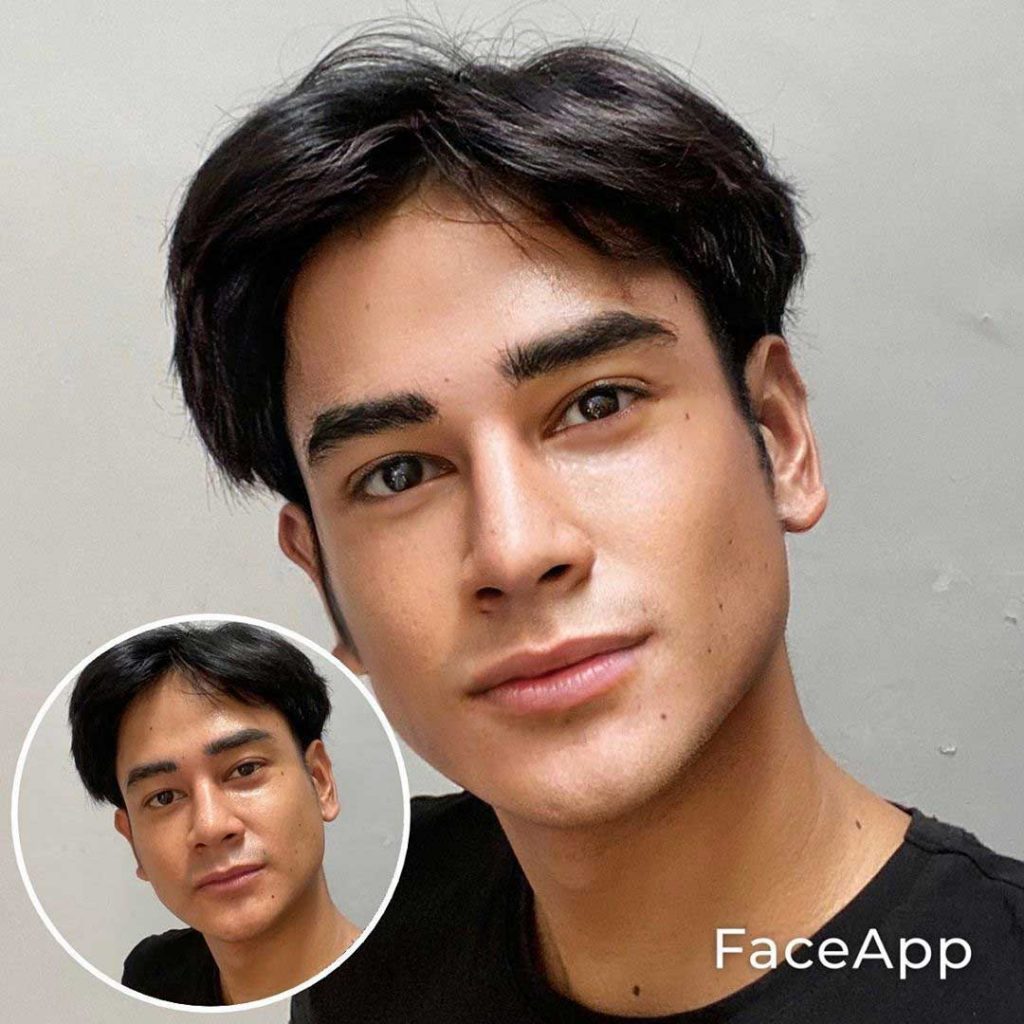 artis dwi-andhika-oplas-challenge-artis