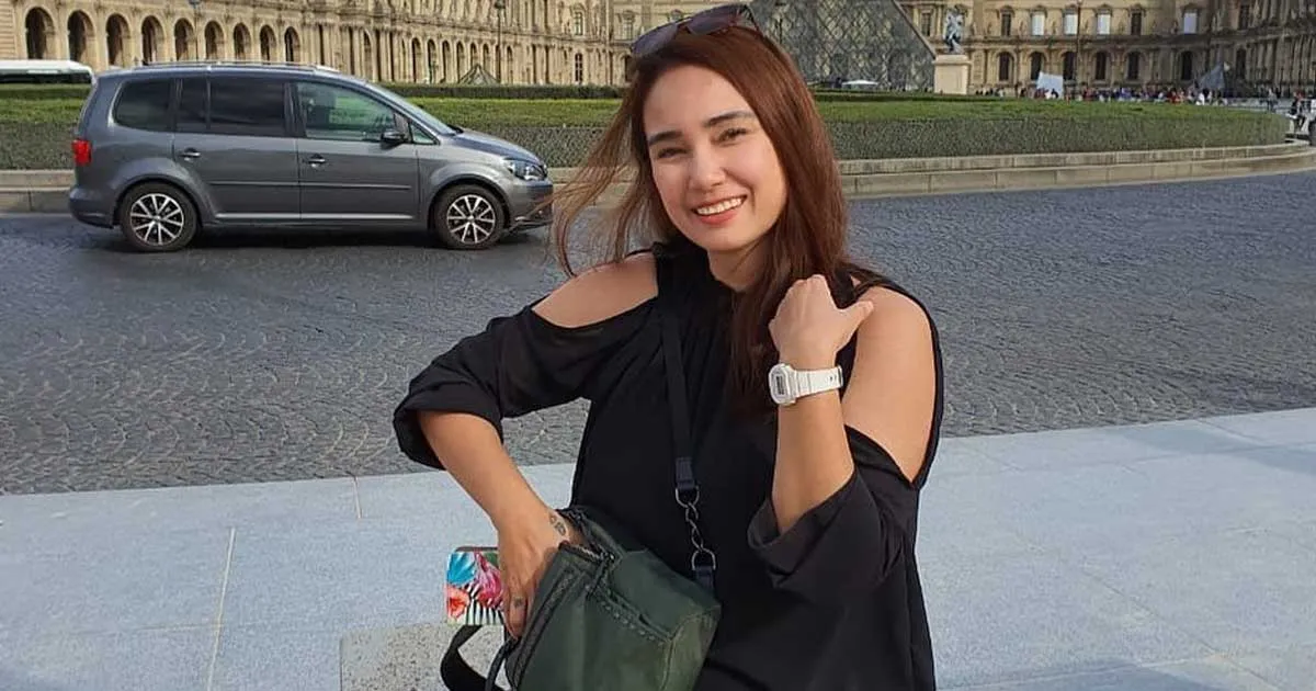 Curhatan Feby Febiola yang Kini Botak usai Jalani Kemoterapi