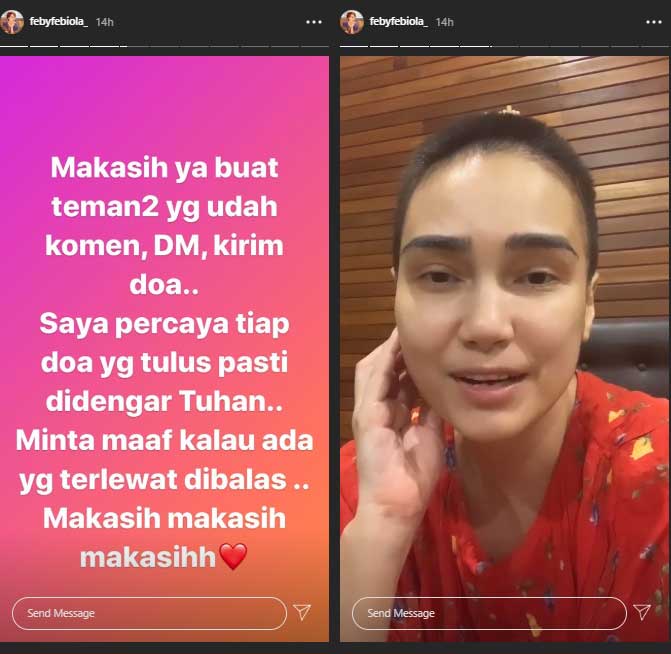 feby-febiola-botak-kemoterapi