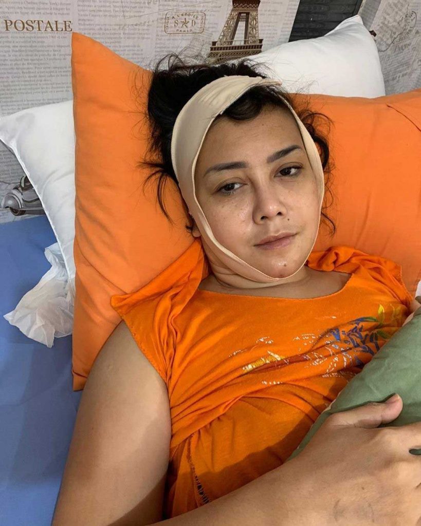 kondisi-kakak-elma-theana-setelah-operasi-jadi-korban-malpraktik
