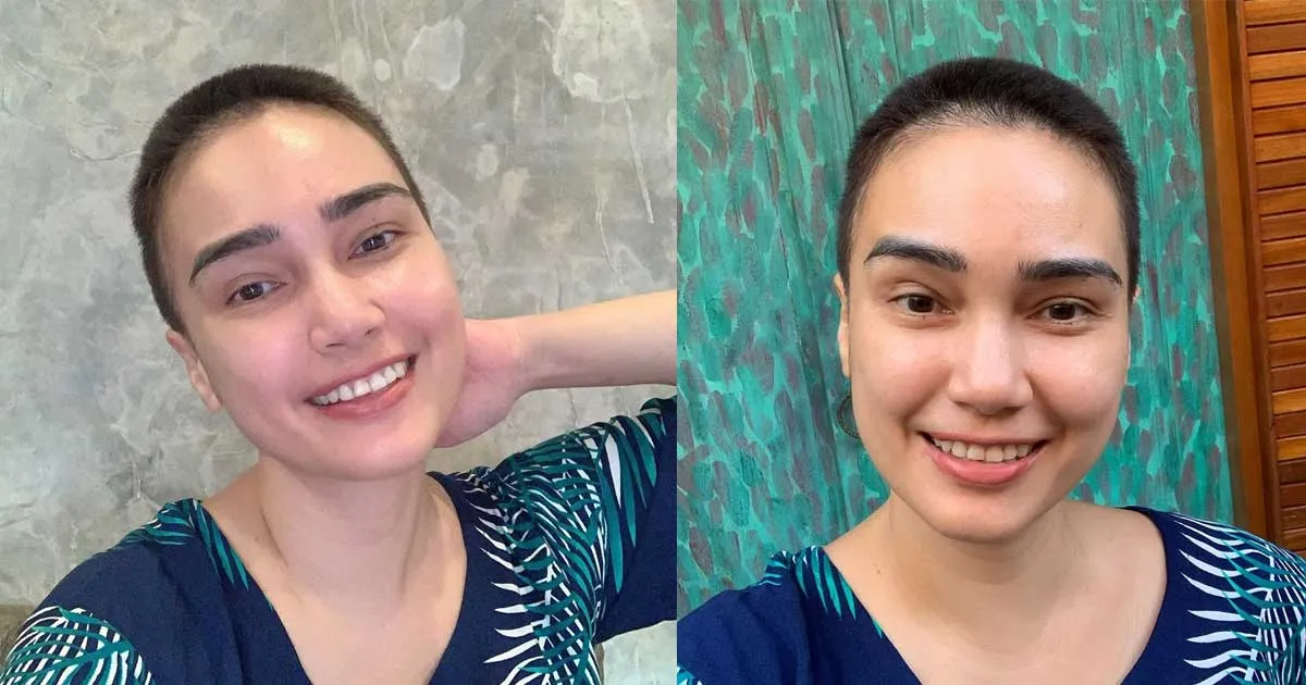 Penuhi Janji, Feby Febiola Ungkap Penyakit yang Dideritanya