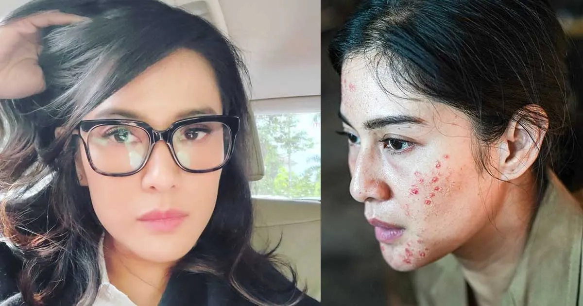 Wajah Penuh Jerawat, Dian Sastro Beber Penyebabnya