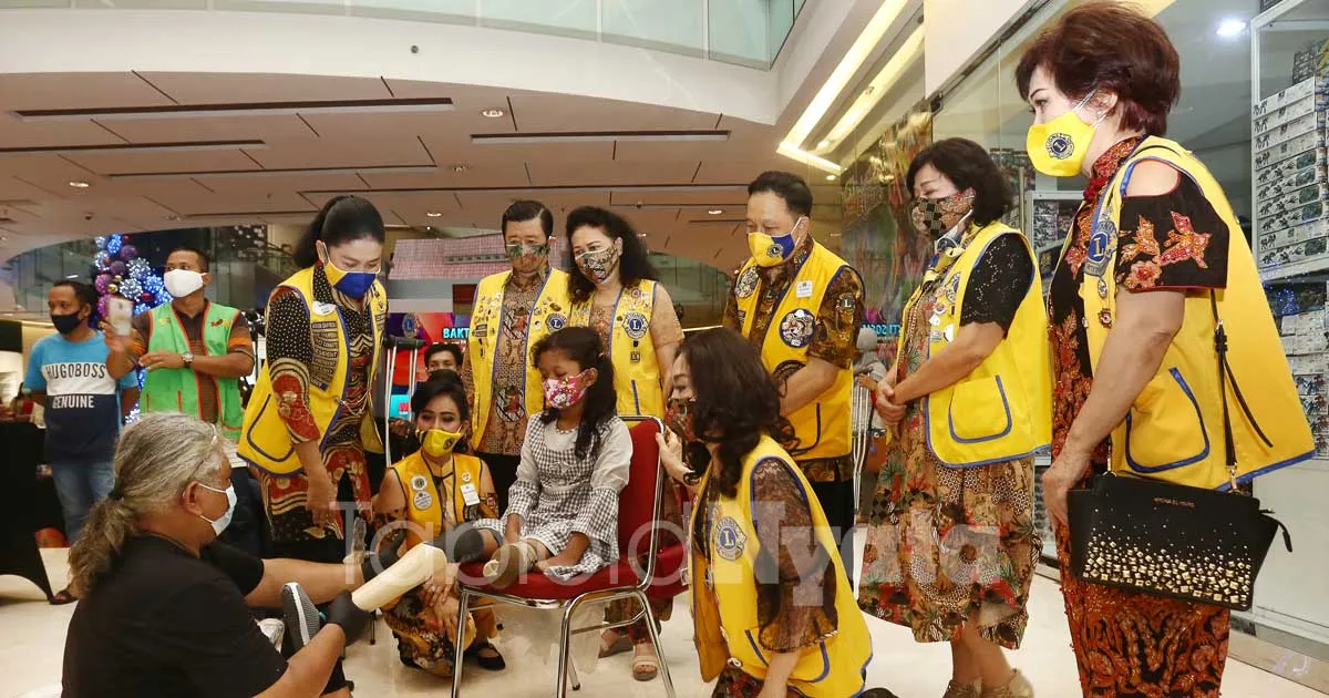 Ultah ke-7, Lions Club Surabaya Shining Bagikan Kaki Palsu