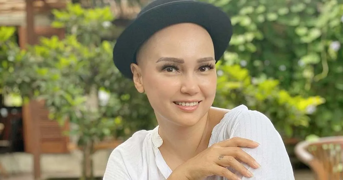6 Kali Jalani Kemoterapi, Feby Febiola dapat Keajaiban