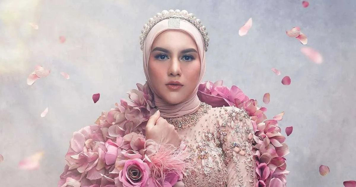 Hilangkan Gigi Gingsul, Intip 4 Gaya Baru Irish Bella yang Makin Manis