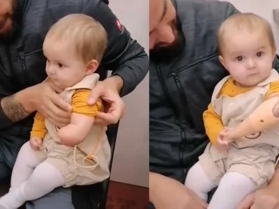 lengan-pertama-untuk-baby-leia-prostethic-arm-video-sedih-tiktok