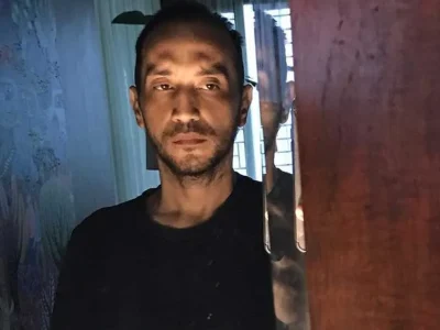 gary iskak sakit kanker hati sirosis 1.jpg