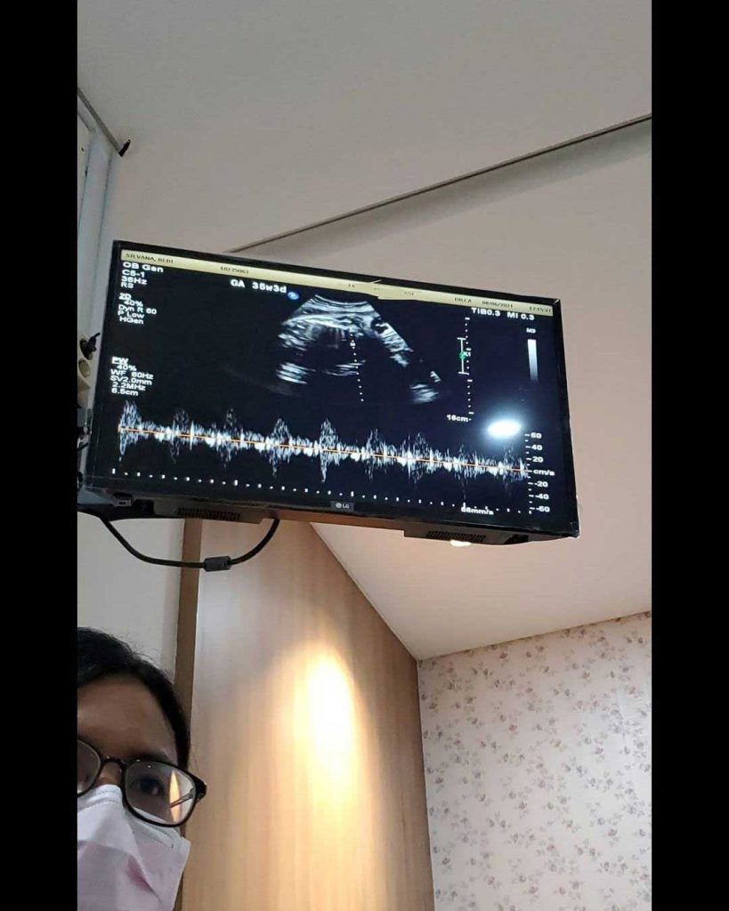 tes kandungan istri opick kondisi bayi janin