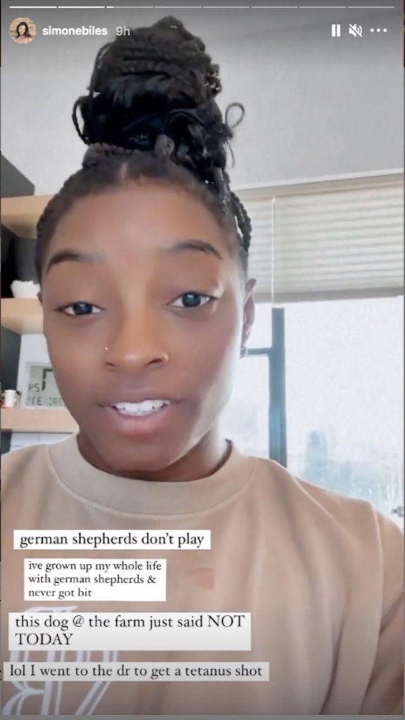 Simone biles digigit anjing