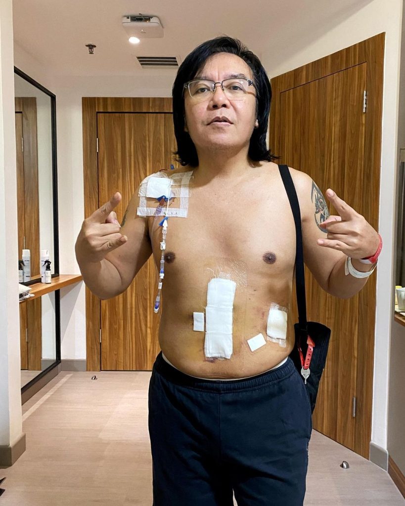 ari lasso kanker limfa