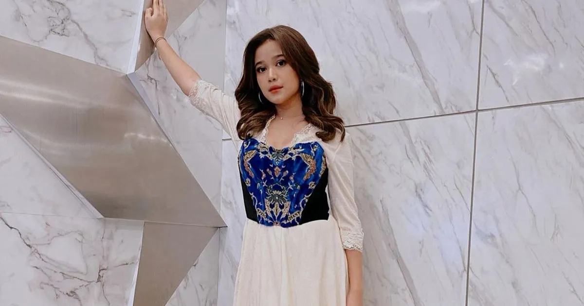 Cerita Brisia Jodie Alami Kecelakaan Saat Syuting Love Knots