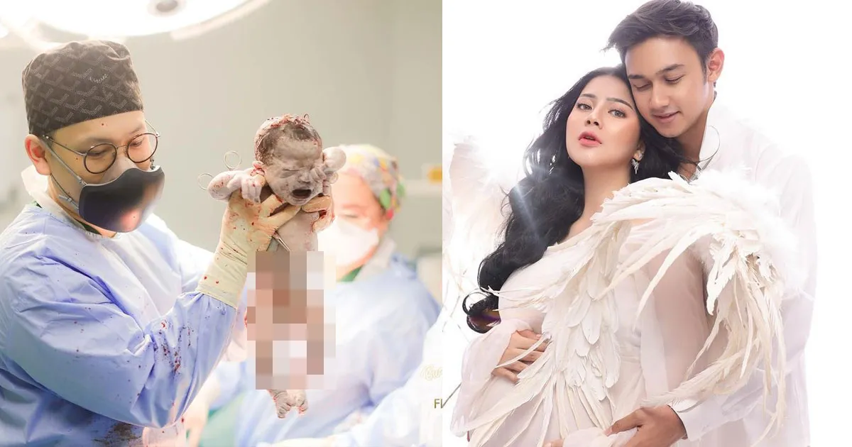 Ini Detik-detik Persalinan Pesinetron Felicya Angelista. Penuh Haru dan Banjir Air Mata