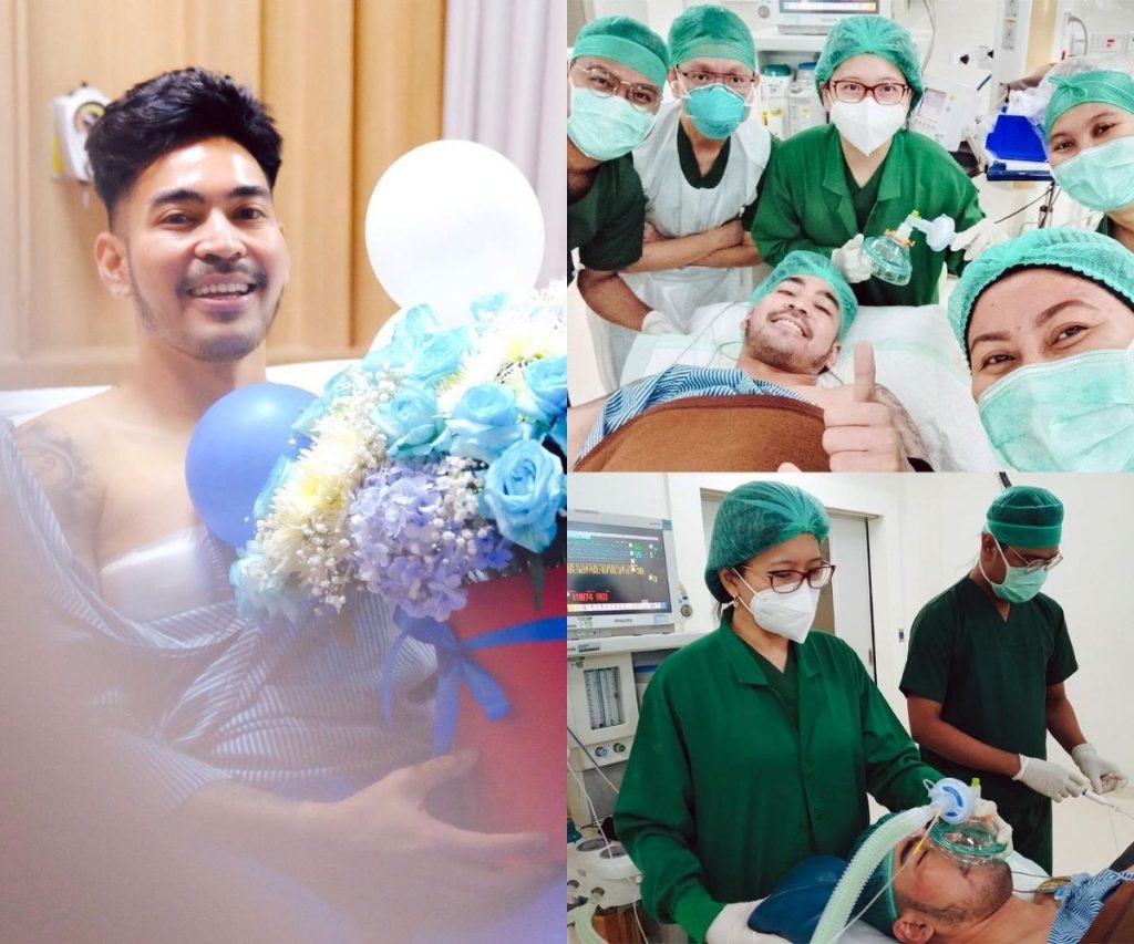 robby purba pasca operasi tumor payudara