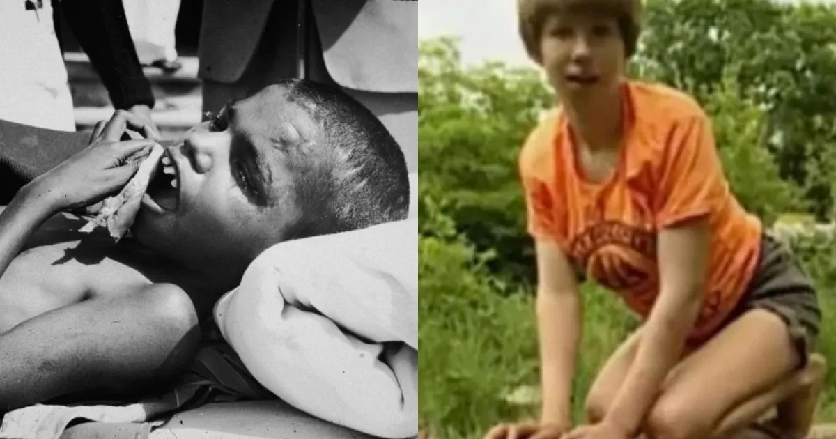 Horor! Ini Anak-Anak Paling Liar di Dunia. Ada yang Dirawat Serigala Hingga Monyet