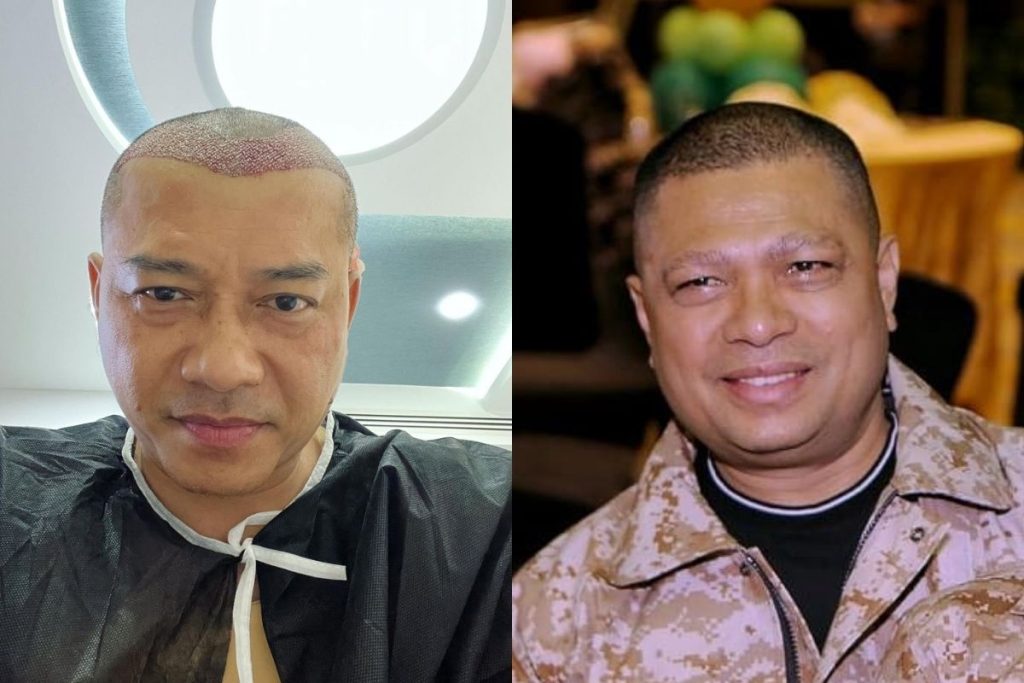 anang hermansyah mirip raul lemos