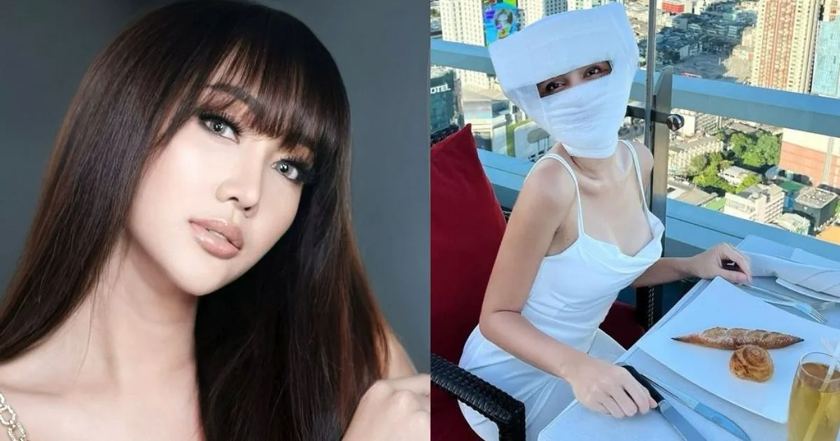 Akhirnya Lepas Perban, Lucinta Luna Ngaku Mirip Idol Korea. Siapa?
