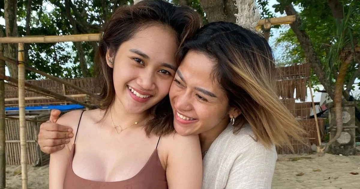 Oplasnya Dicap Gagal. Hidung Putri Farida Nurhan Bengkak dan Bikin Ngilu