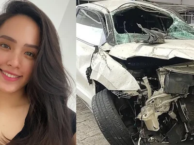 Lady Nayoan Alami Cedera Otot Usai Kecelakaan Bersama Rendy Kjaernett. Kondisinya Belum Stabil!