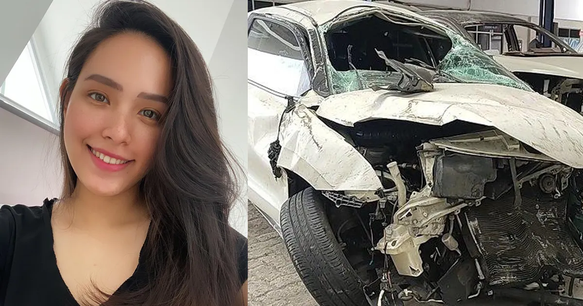 Lady Nayoan Alami Cedera Otot Usai Kecelakaan Bersama Rendy Kjaernett. Kondisinya Belum Stabil!