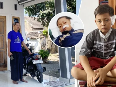 Miris! Telinga Bocah SMP di Pasuruan Putus Akibat Digigit Teman Ngaji