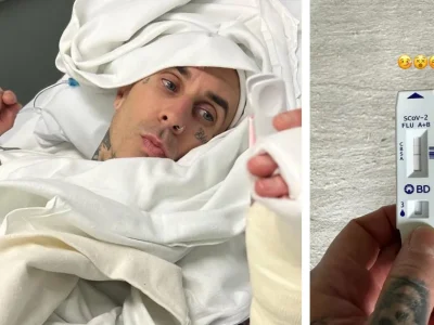 Travis Barker Positif Covid Setelah Comeback di Blink-182 Tour