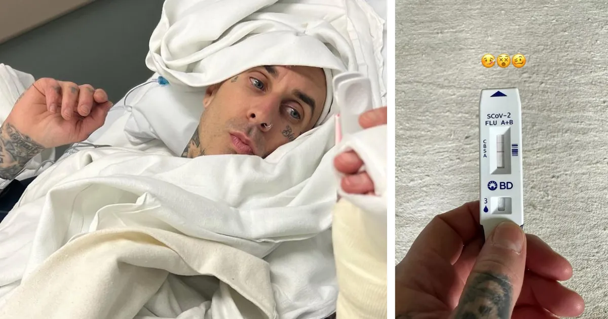 Travis Barker Positif Covid Setelah Comeback di Blink-182 Tour