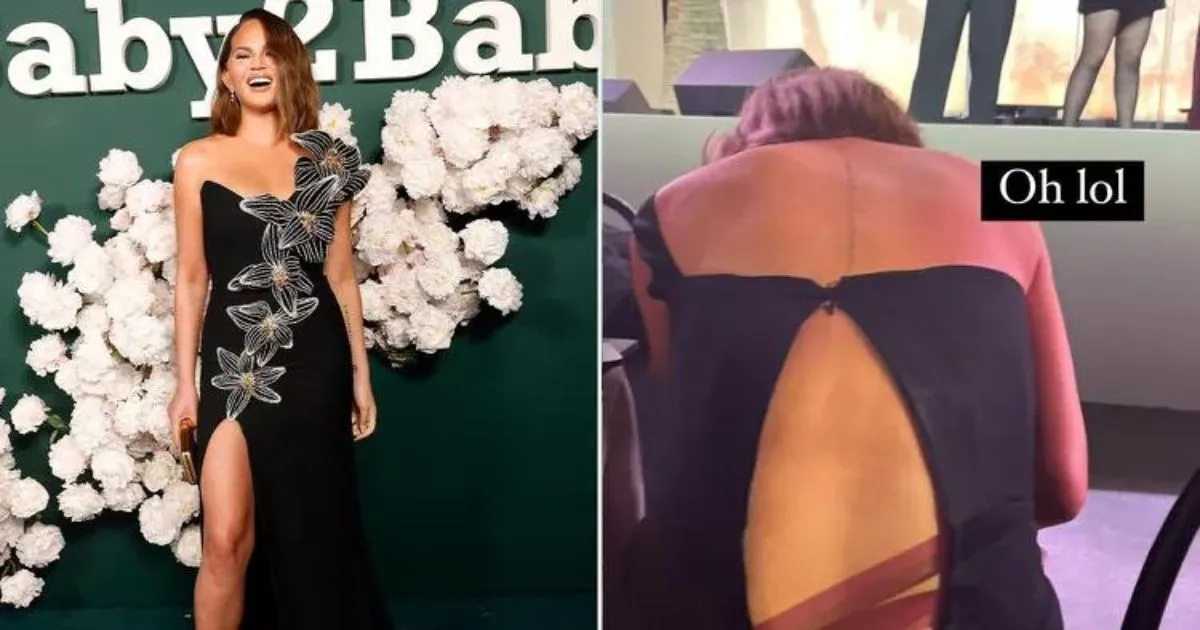 Oups… Resleting Rusak, Chrissy Teigen Tetap Pede di Baby2Baby Gala