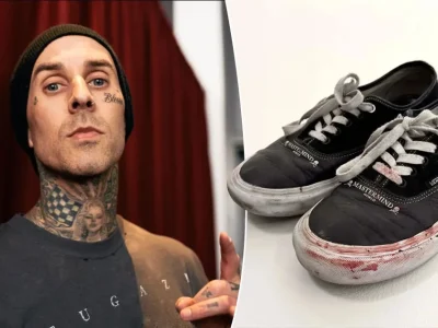 Hiih Ngeri! Sepatu Berlumuran Darah Milik Travis Barker Terjual Rp62 Juta