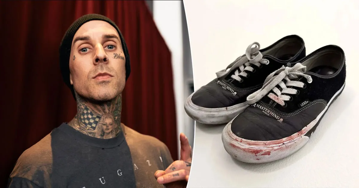 Hiih Ngeri! Sepatu Berlumuran Darah Milik Travis Barker Terjual Rp62 Juta