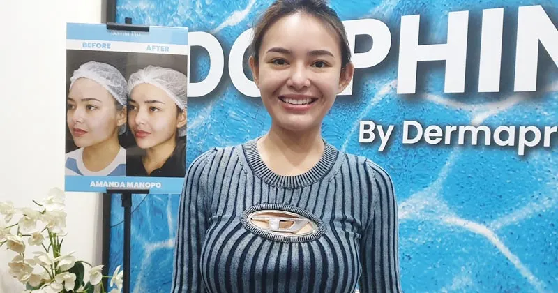 Amanda Monopo Operasi Plastik? Cek Faktanya!