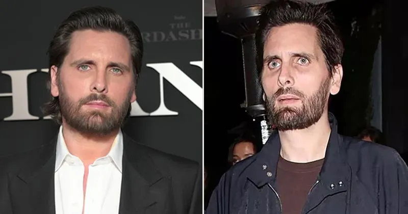 Memprihatinkan! Scott Disick Setelah Berat Badannya Anjlok