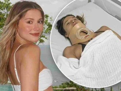 Mantan Miss Universe Australia, Daria Varlamova alamai cedera serius akibat kecelakaan. (Foto: Dok. Dailymail)